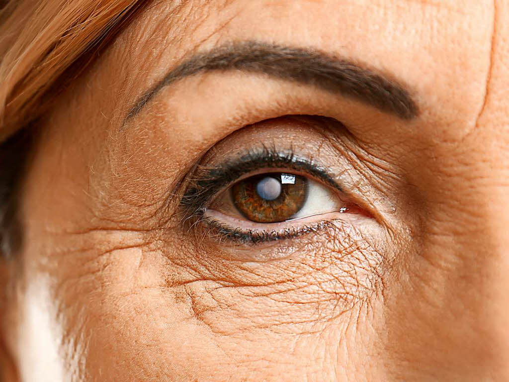 Eine künstliche Linse hilft Patienten mit Grauem Star - Gesundheit