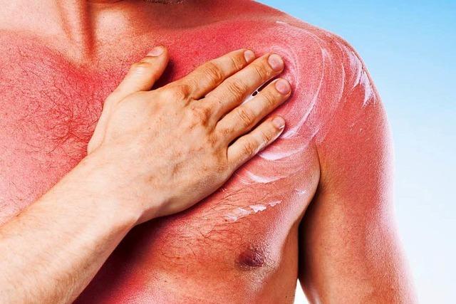 Was man zum Thema Hautkrebs und Sonne wissen muss