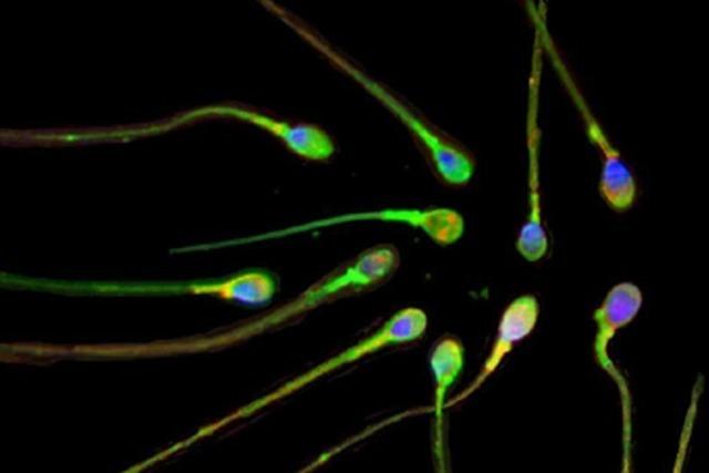 Spermienproduktion in der westlichen Welt ist gesunken