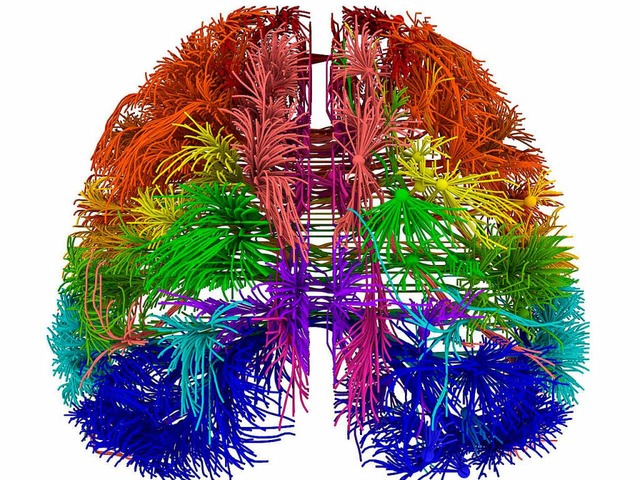 Das Modell zeigt einige, aber beileibe...enverbindungen im menschlichen Gehirn.  | Foto: dpa (2)/AFP