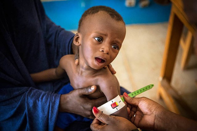 Unterernhrtes Kind in Mali  | Foto: dpa