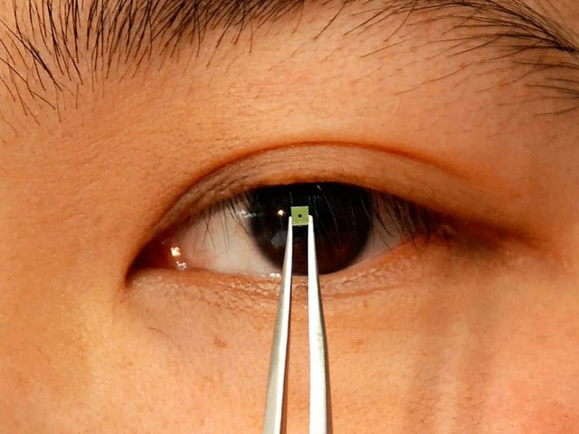 So ein winziger Chip steckt auch in einem Retina-Implantat.  | Foto: Frank Hagmeyer