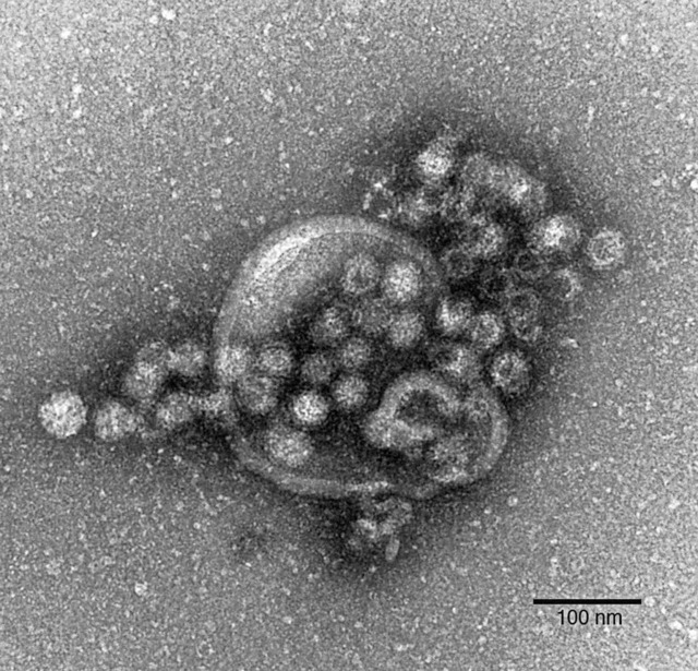 Elektronenmikroskopische Aufnahme von Noroviren .   | Foto: Robert-Koch-Institut/dpa