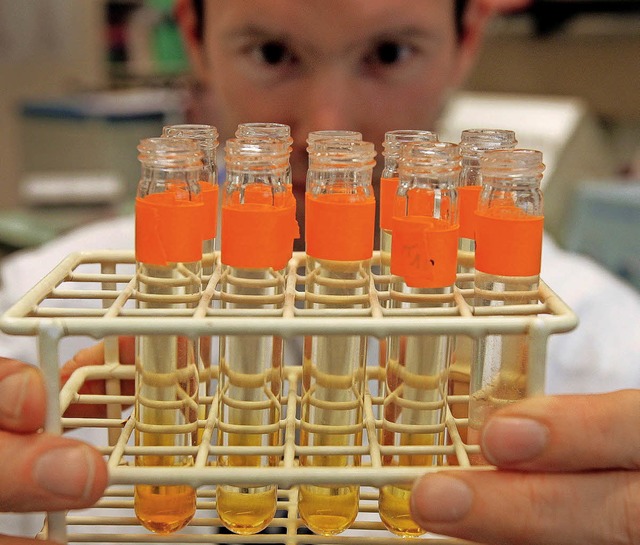 Urinproben, die auf Doping getestet we... Recherchen ein windiges Unterfangen.   | Foto: dpa