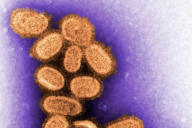 Virus der Spanischen Grippe  | Foto: Verwendung weltweit, usage worldwide