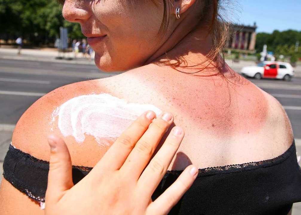 Für Menschen mit heller Haut bedeutet ... Sonnenlicht ein erhöhtes Krebsrisiko.  | Foto: dpa