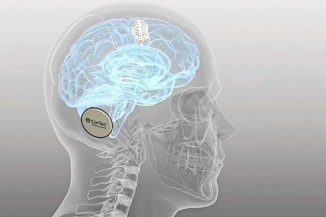 High-Tech-Medizintechnik Cortec aus Südbaden kann Epilepsie- und Parkinson-Patienten helfen
