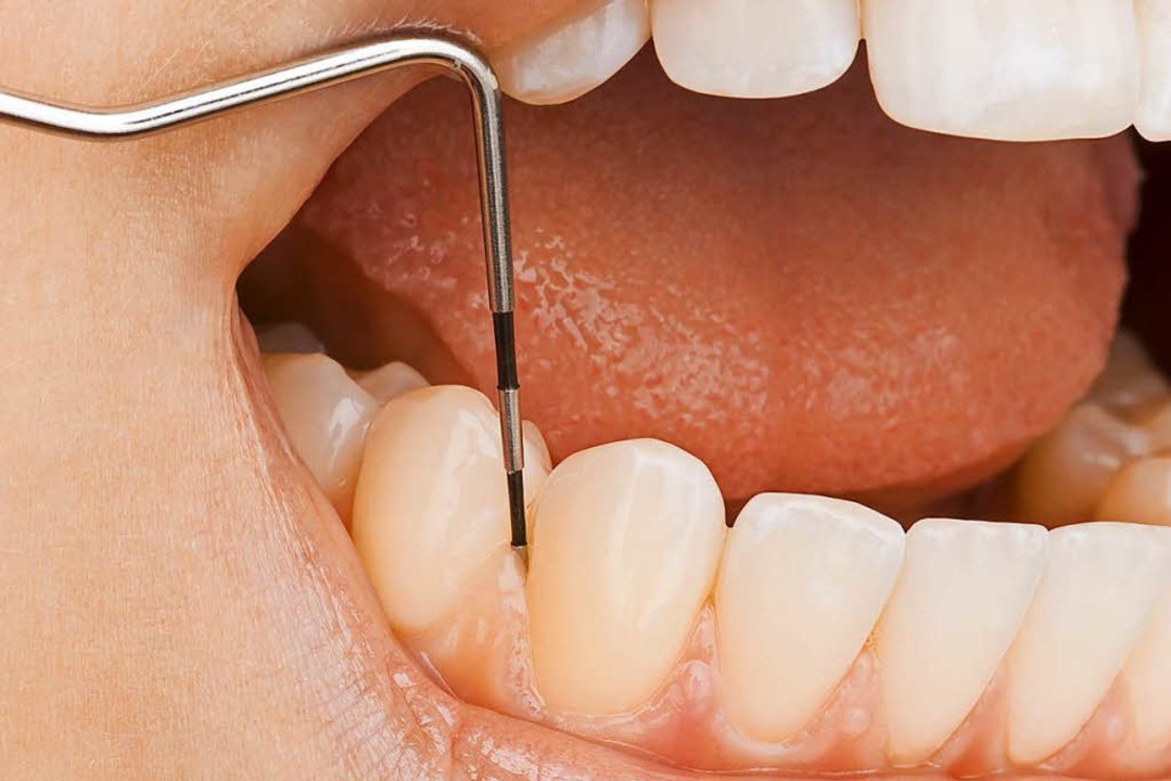Gepflegte Zähne sind wichtig den ganzen Körper aus.    | Foto: Adobe