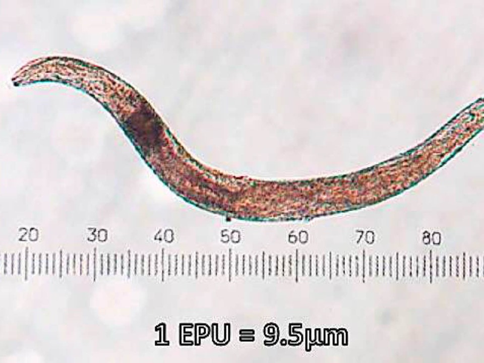 Der Wurm Caenorhabditis elegans &#8211; kaum grer, als ein Stecknadelkopf.  | Foto: Peter Andrus/Creative Commons