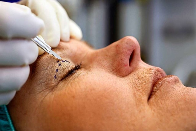 Ein Schnheitschirurg malt eine Linie ... des Augenlids dieser Patientin hilft.  | Foto: Jens Schierenbeck