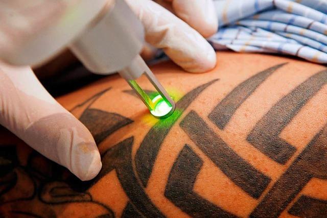 Nur Ärzte dürfen künftig Tattoos entfernen