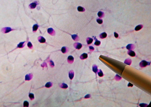 Ein Spermiogramm macht die Panne sichtbar.  | Foto: Verwendung weltweit, usage worldwide