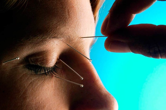 Kann Akupunktur helfen?  | Foto: Bernd_Thissen