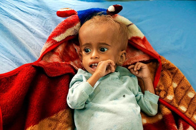 Lebensmittel in Jemen sind fr viele M...211; vor allem Kinder leiden darunter.  | Foto: Mohammed Mohammed