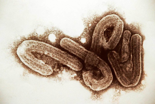 Die Abbildung zeigt Ebola-Viren, die e...tdlichen Marburg-Virus verwandt sind.  | Foto: dpa