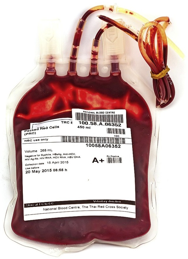 Blutspenden mssen ab Herbst auf Hepatitis E getestet werden. 