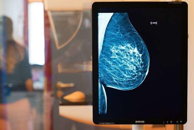 Forscher melden Patent fr Brustkrebserkennung per Bluttest an