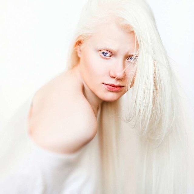 Was ist ein Albino?  | Foto: Tatsiana Tsyhanova  (stock.adobe.com)