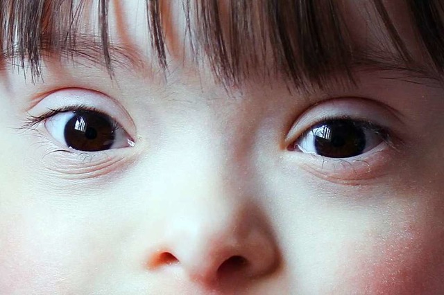 Auch an der speziellen Augenform lsst... ein &#8222;Schlag ins Gesicht&#8220;.  | Foto: denys_kuvaiev  (stock.adobe.com)