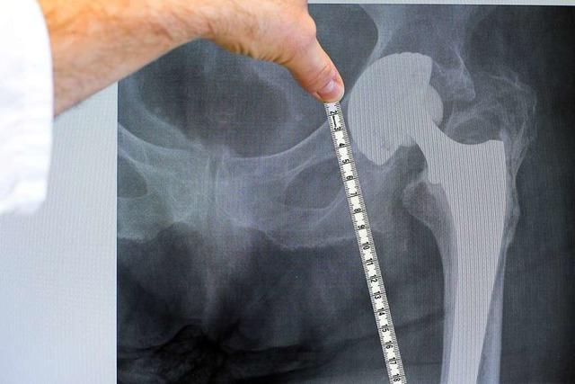Klägerinnen bekommen wegen fehlerhafter Hüftprothesen bis 25.000 Euro Schmerzensgeld