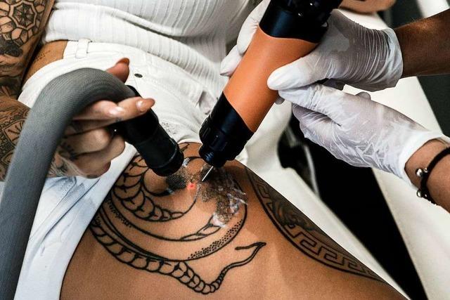 Ab Ende 2020 dürfen nur noch Ärzte Tattoos entfernen