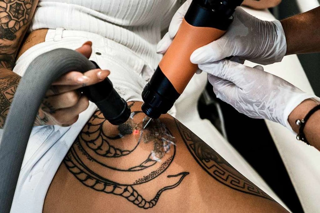 Ab Ende 2020 dürfen nur noch Ärzte Tattoos entfernen Panorama