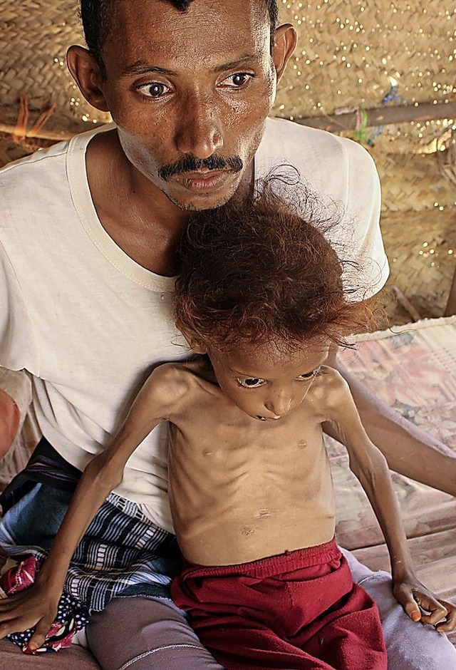 Whrend die Soldaten Krieg fhren, hungern viele Menschen im Jemen.  | Foto: ESSA AHMED (AFP)