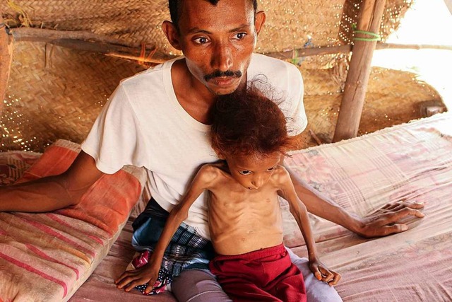 Whrend die Soldaten Krieg fhren, hungern viele Menschen im Jemen.  | Foto: ESSA AHMED (AFP)