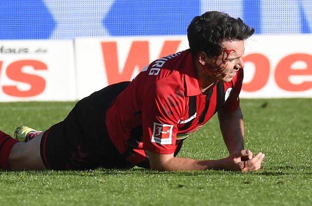 Gezeichnet: Nicolas Hfler zog sich be... gegen Leipzig eine Kopfverletzung zu.  | Foto: THOMAS KIENZLE (AFP)