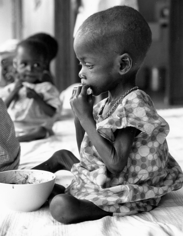 Unterernhrtes Kind in Biafra 1969.  L...uf der Insel So Tom Richtung Biafra   | Foto: Archiv des Deutschen Caritasverbandes