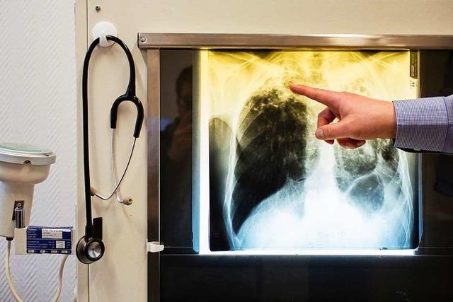 Gesundheitsamt will wegen Tuberkulose-Fall am Ettenheimer Klinikum mehr als 300 Menschen untersuchen