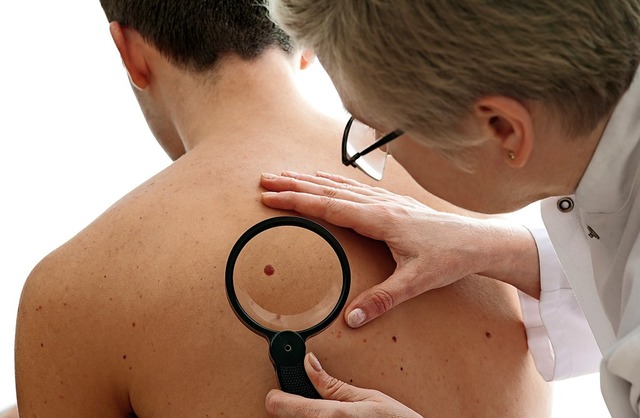 Hautkrebsscreening nur mit Lupe? Haut...auere Blick muss extra bezahlt werden.  | Foto: Alexander Raths - stock.adobe.com