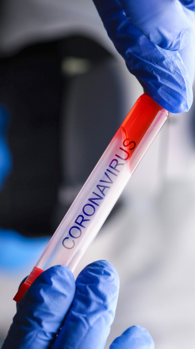 Im Rahmen der Gruppenberwachung durch...tzt auch auf das Coronavirus getestet.  | Foto: H_Ko - stock.adobe.com