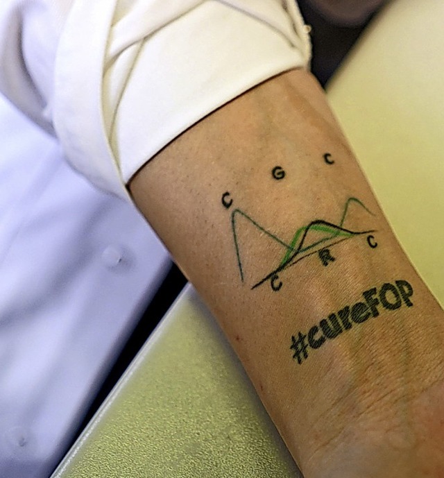Eine Patientin trgt sogar ein Tattoo mit dem Namen ihrer Erkrankung.  | Foto: Jrg Carstensen (dpa)