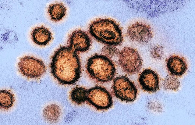 Das SARS-CoV-2, aufgenommen mit einem ..., das die Krankheit  Covid-19 auslst.  | Foto: HANDOUT (AFP)