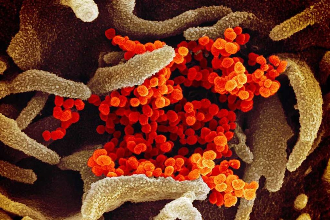 Das Coronavirus SARS-CoV-2.  | Foto:  (dpa)