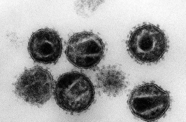 HI-Viren, die Erreger der Krankheit Aids   | Foto: Hans Gelderblom (dpa)