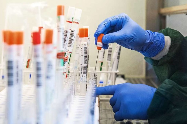In den Laboren, die auf das Coronaviru..., mangelt es zunehmend an Chemikalien.  | Foto: Daniel Bockwoldt (dpa)