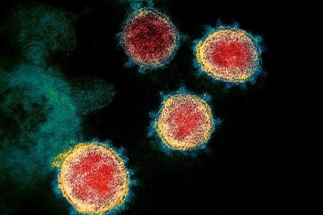 Studie: Coronavirus könnte auch das Nervensystem schädigen