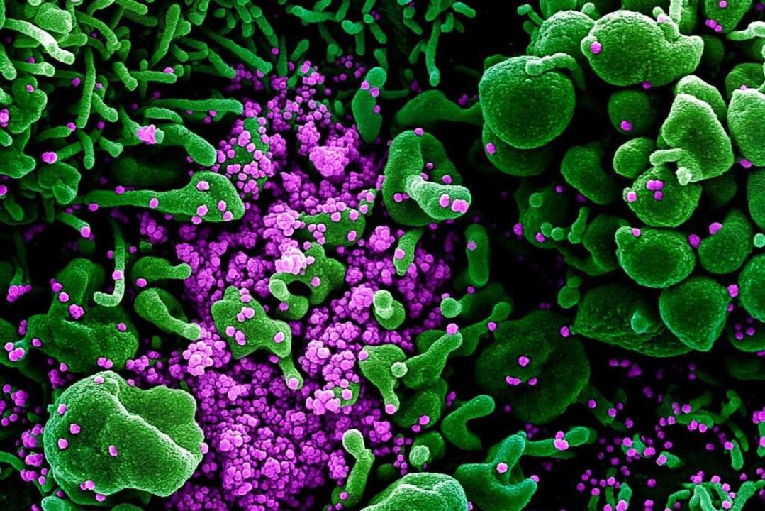Auf dieser vom US-Forschungszentrum Na...it dem Coronavirus violett) infiziert.  | Foto: Niaid (dpa)