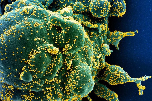 Eine Zelle (grn), die mit Coronaviren (gelb) infiziert ist.  | Foto: Niaid (dpa)