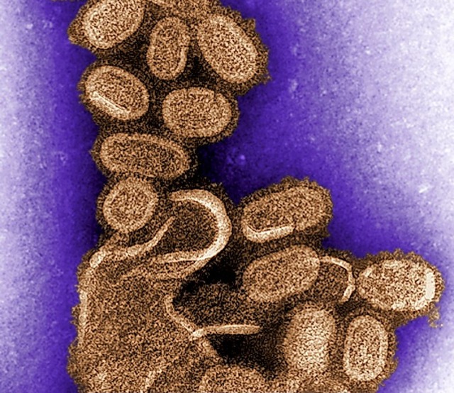 Ein nachgezchtetes Grippe-Virus  | Foto: -