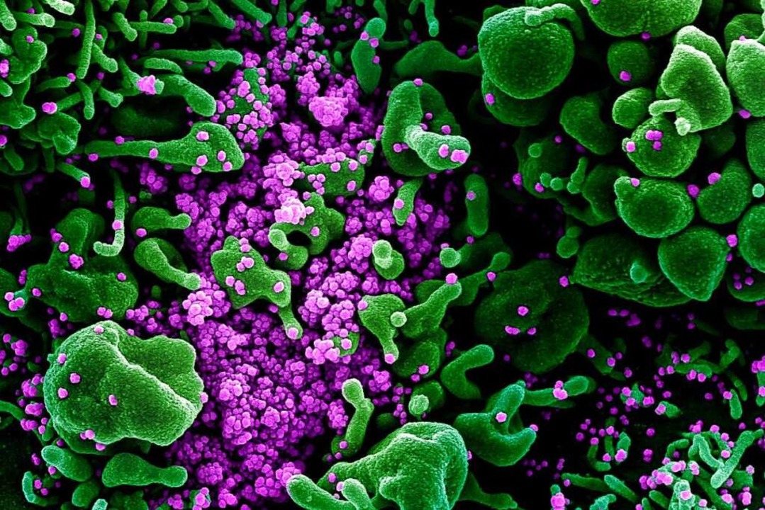 Das Sind Die Neuesten Wissenschaftlichen Erkenntnisse Zum Coronavirus Gesundheit Ernahrung Badische Zeitung