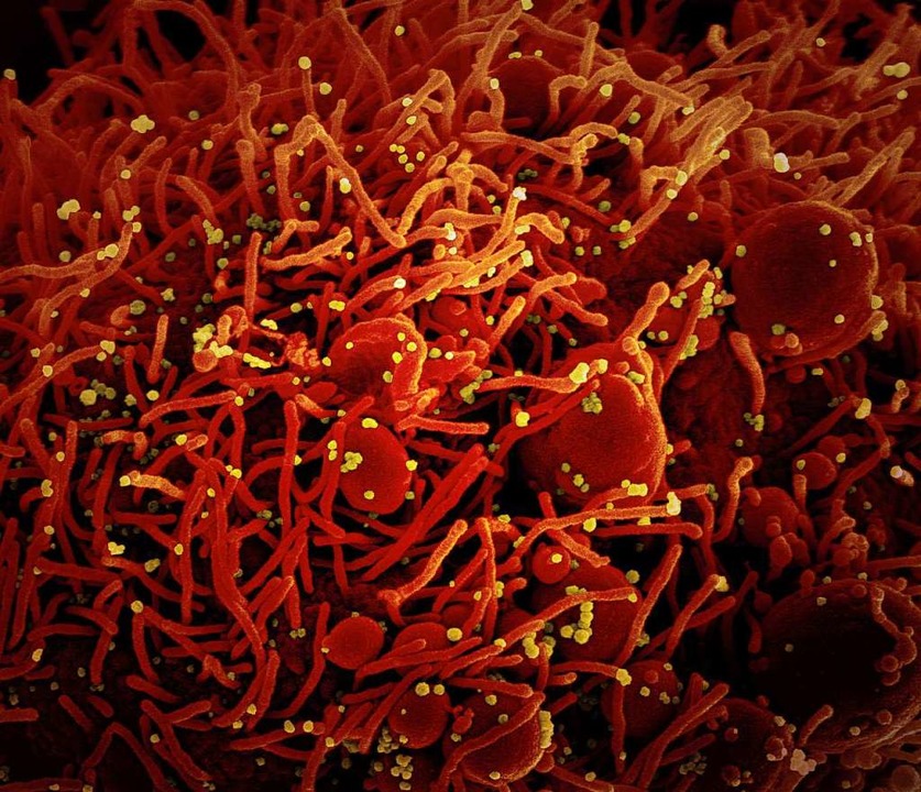 Auf dieser Aufnahme des US-Forschungsz... mit dem Coronavirus (gelb) infiziert.  | Foto: Niaid (dpa)