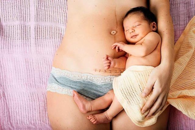 Fast jedes dritte Kind in Deutschland kommt per Kaiserschnitt zur Welt