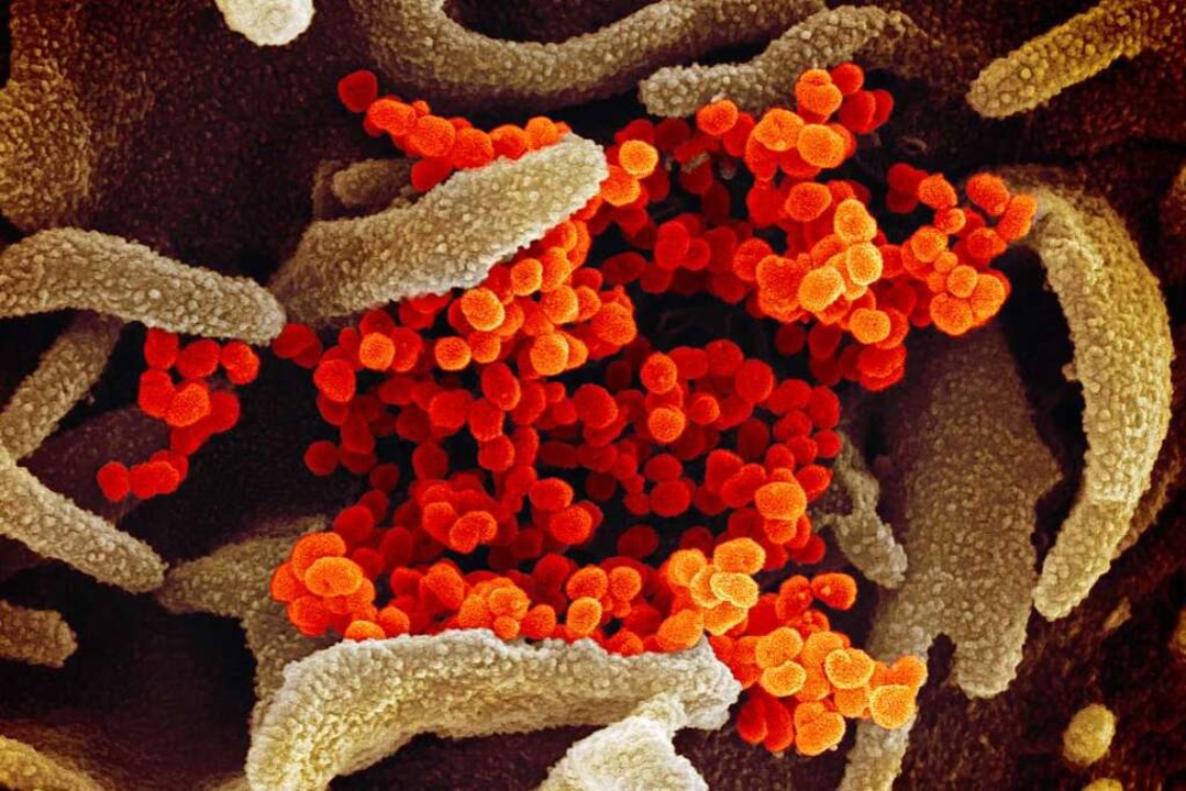 Das Coronavirus Sars-CoV-2, vergrößert von einem Elektronenmikroskop.  | Foto: - (dpa)