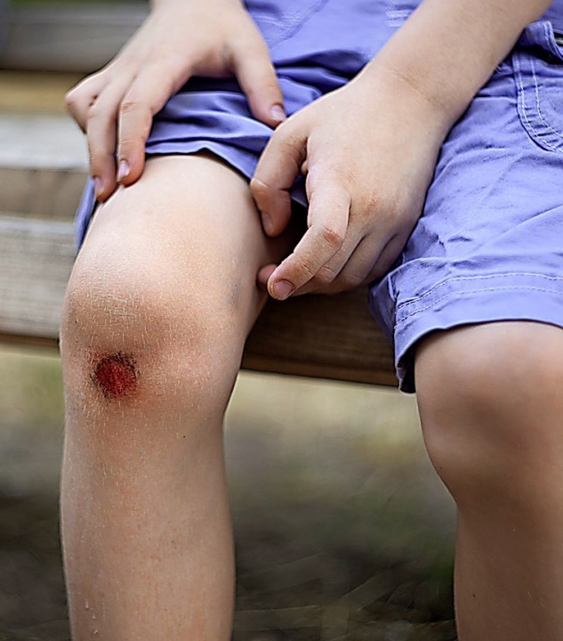 Hingefallen? Stoffe im eigenen Blut versorgen die Wunde.  | Foto: Hanna  (stock.adobe.com)