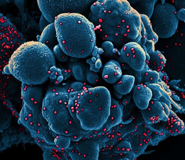 Dieses Bild zeigt eine Zelle (blau), die von Coronaviren (rot) befallen ist.  | Foto: Niaid (dpa)