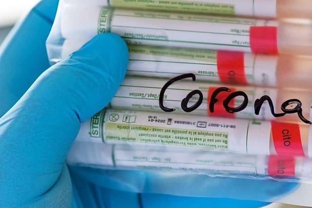 Ein Labor hat reihenweise falsche Corona-Ergebnisse geliefert