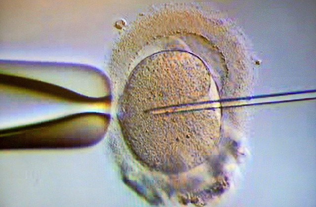 Ein Spermium wird in eine Eizelle gegeben.  | Foto: Klaus-Dietmar Gabbert (dpa)